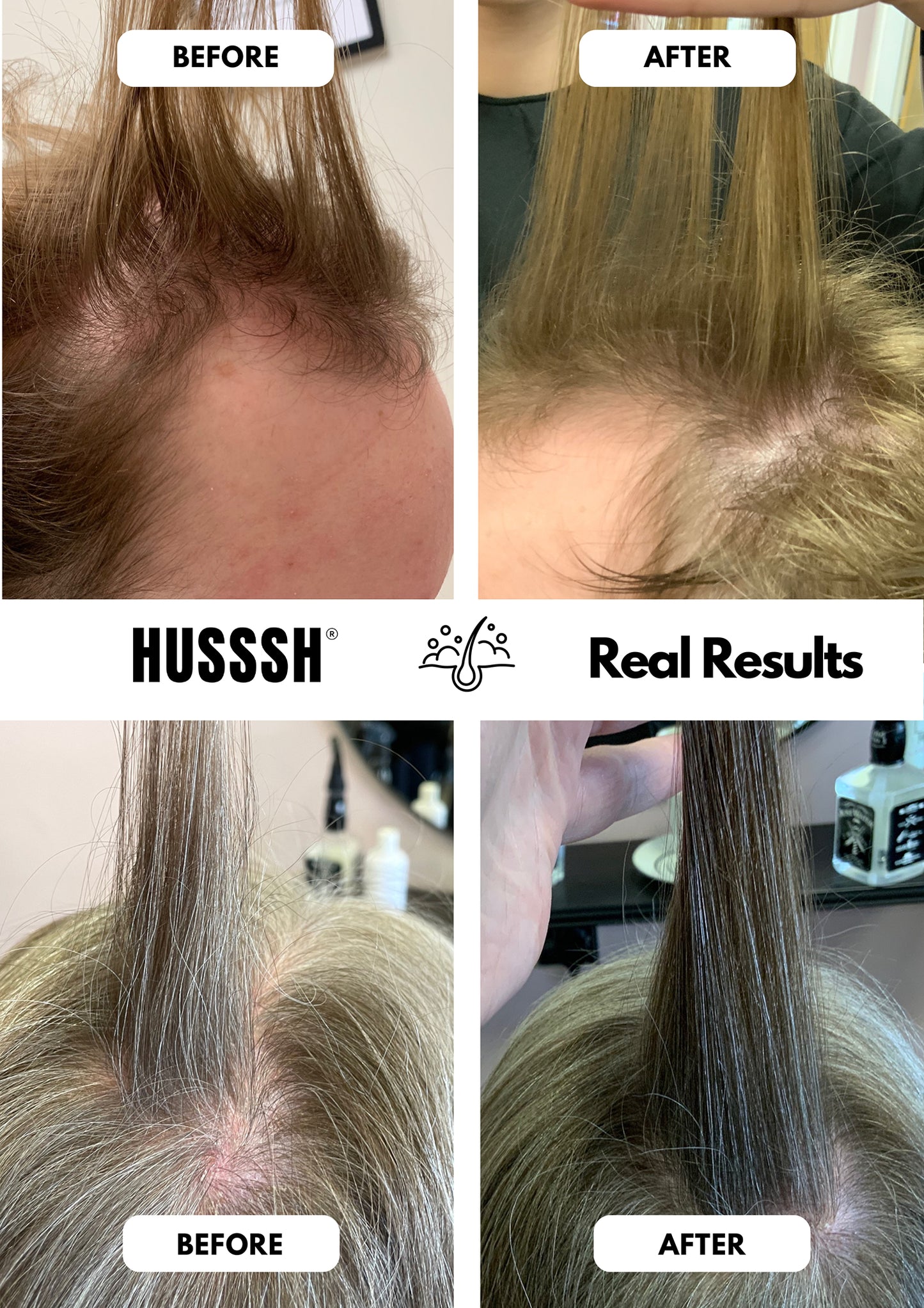 Champú unisex Anticaída
Ayuda a detener la caída y a devolver cuerpo y densidad al cabello fino y debilitado