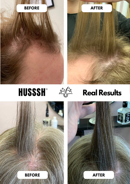 Champú unisex Anticaída
Ayuda a detener la caída y a devolver cuerpo y densidad al cabello fino y debilitado