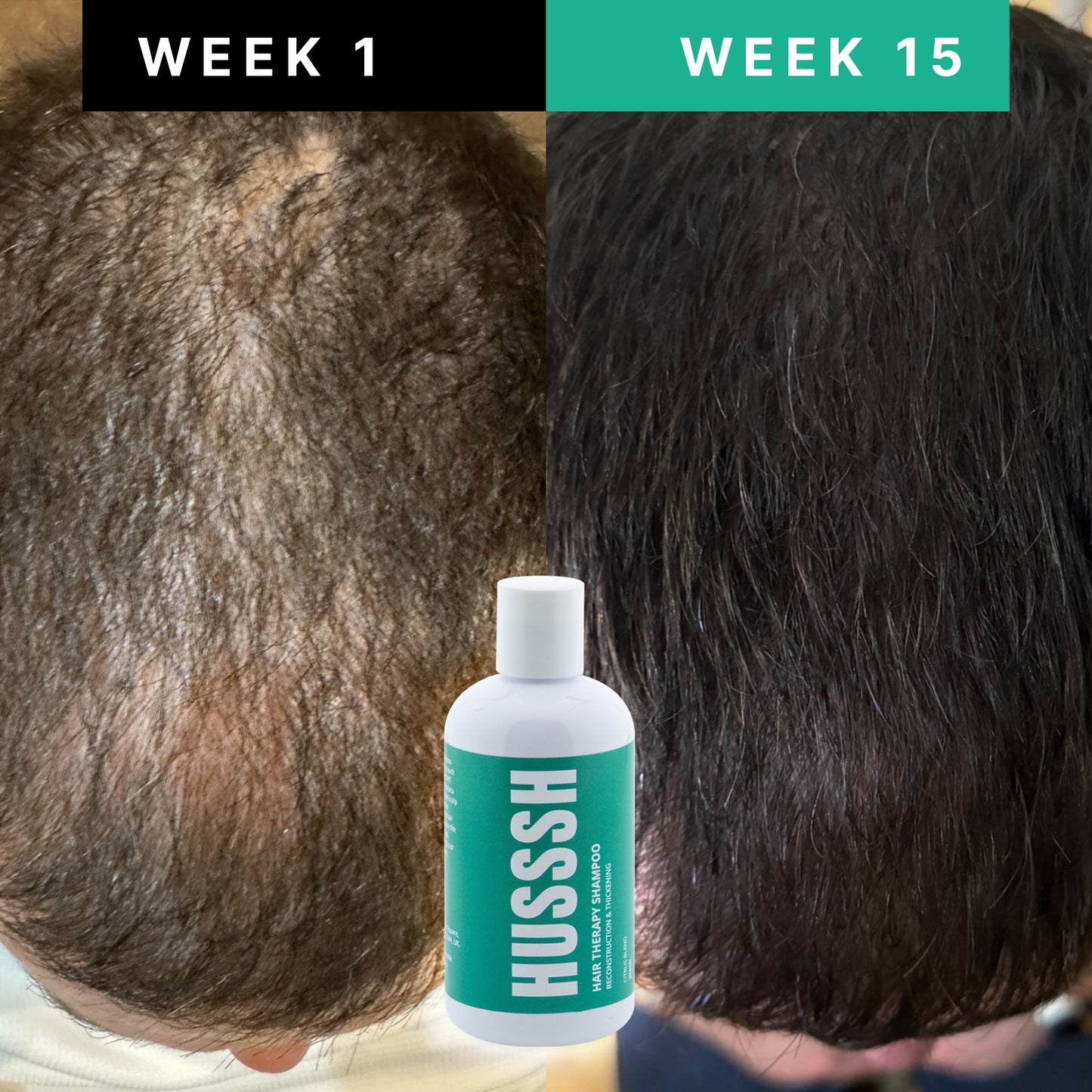 Champú unisex Anticaída
Ayuda a detener la caída y a devolver cuerpo y densidad al cabello fino y debilitado