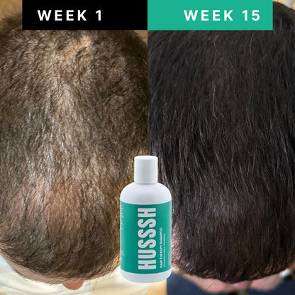 Champú unisex Anticaída
Ayuda a detener la caída y a devolver cuerpo y densidad al cabello fino y debilitado